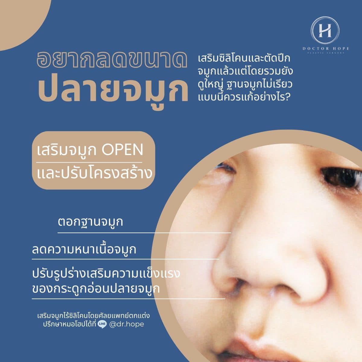 จมูกชมพู่ จมูกใหญ่ จมูกทู่ ไม่ต้องทน!