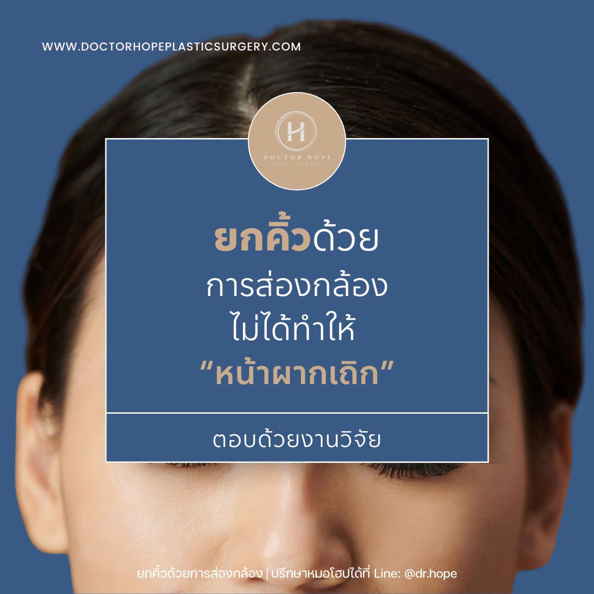 ยกคิ้วด้วยการส่องกล้อง ทำให้หน้าผากกว้างขึ้น จริงไหม