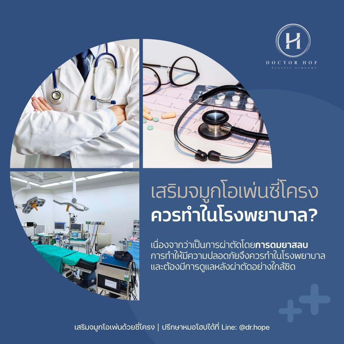 เสริมจมูกโอเพ่นด้วยซี่โครง ควรทำในโรงพยาบาล