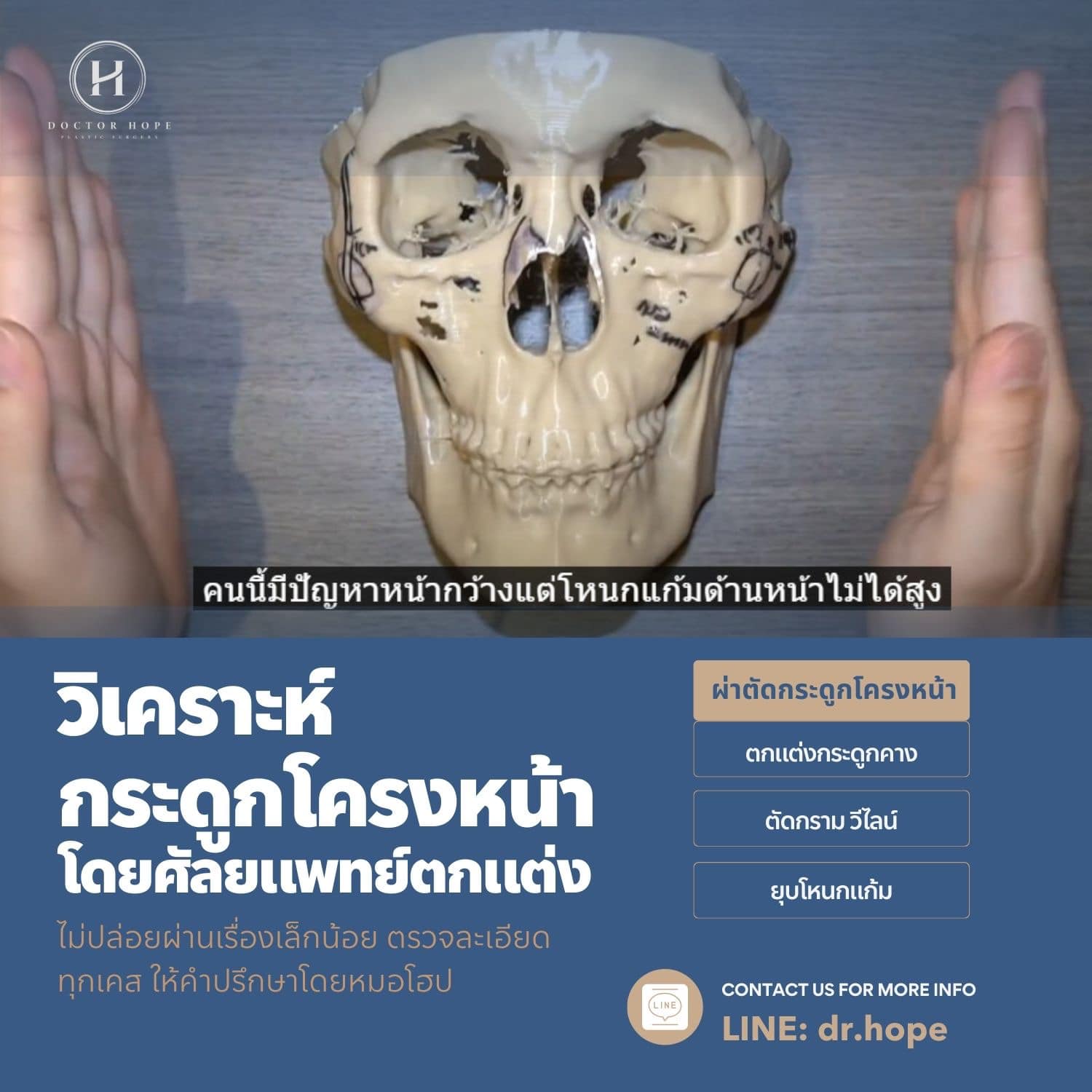 วิเคราะห์กระดูกโครงหน้า โดยศัลยแพทย์ตกแต่ง