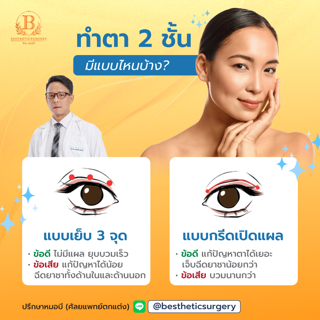 ทำตา 2 ชั้น มีแบบไหนบ้าง ?