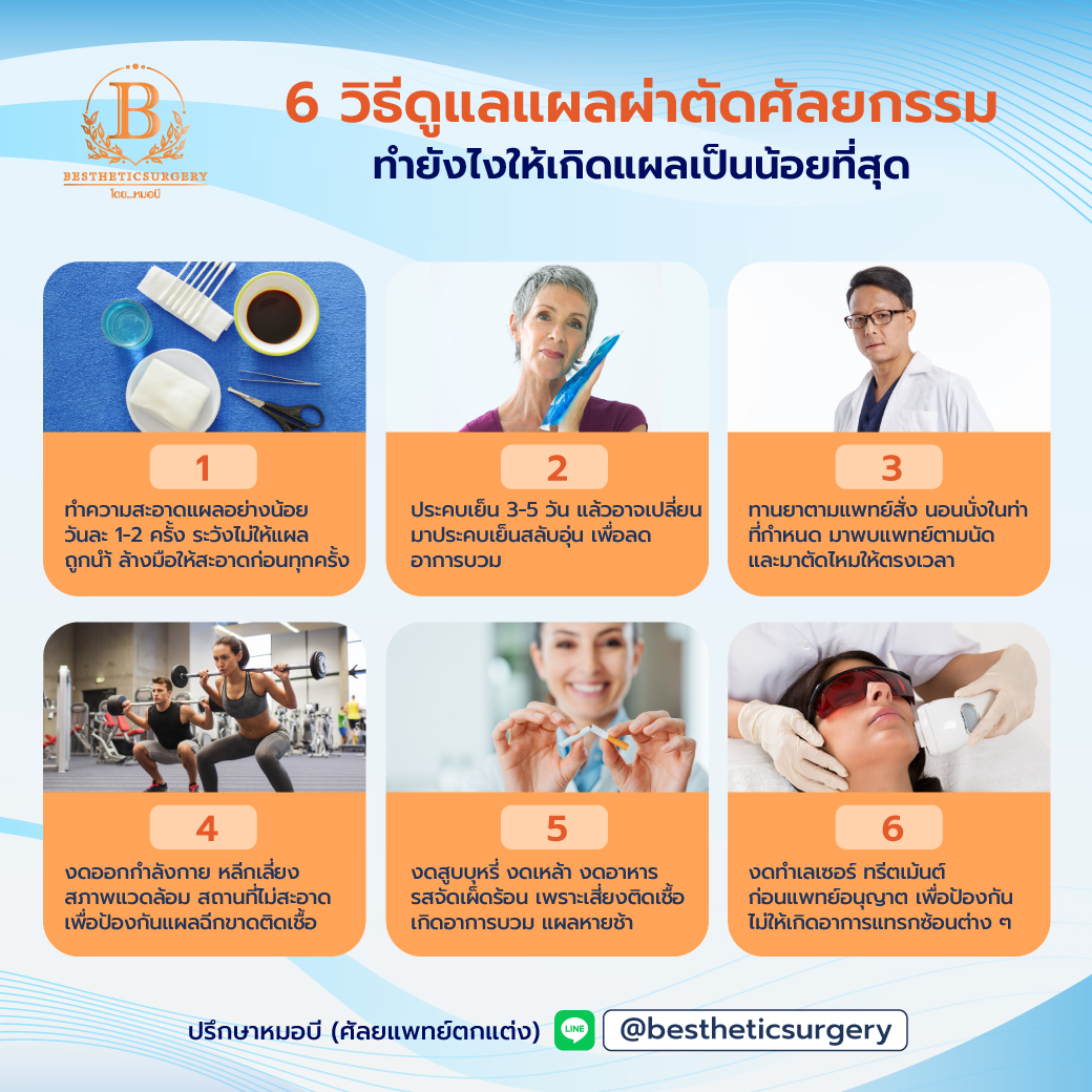 6 วิธีดูแลแผลผ่าตัดหลังศัลยกรรม