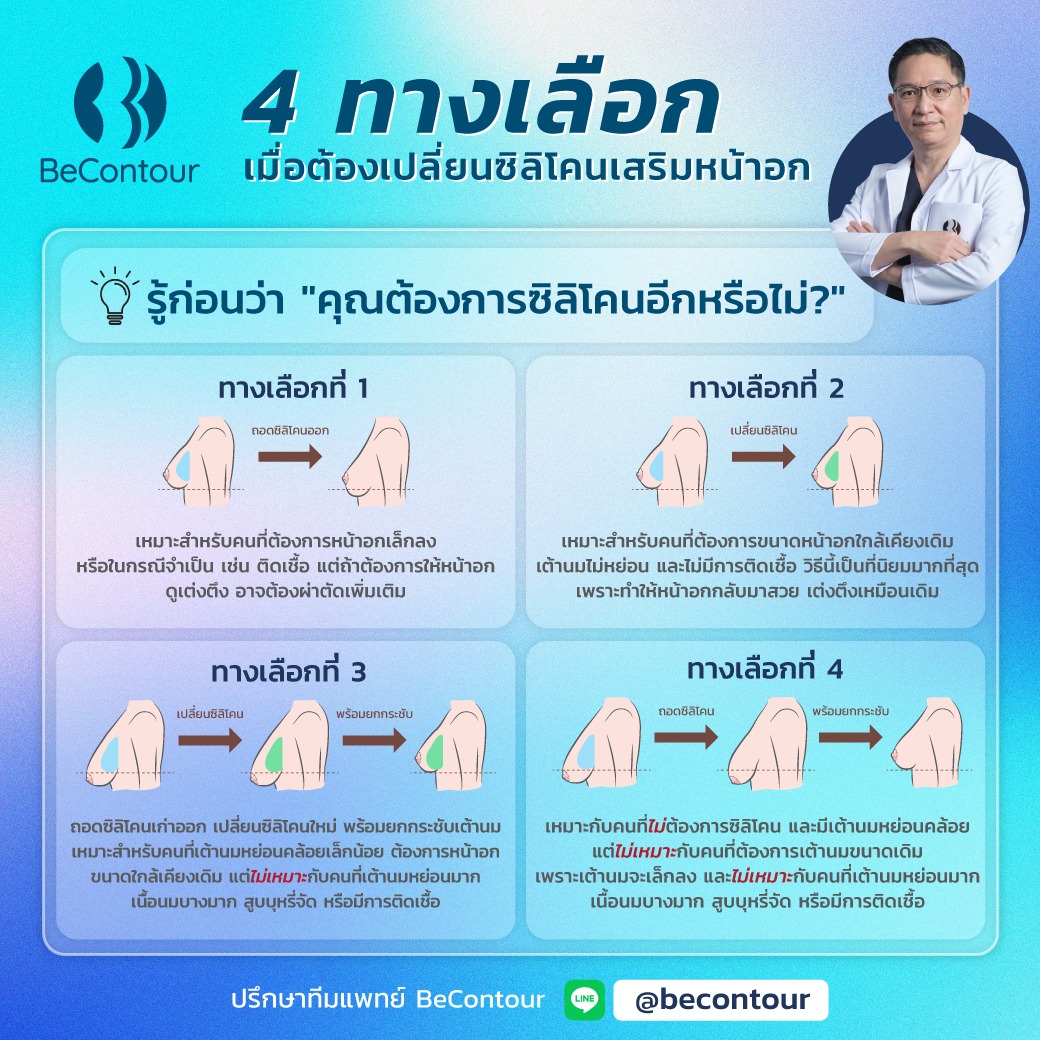 4 ทางเลือก เมื่อต้องเปลี่ยนซิลิโคนเสริมหน้าอก
