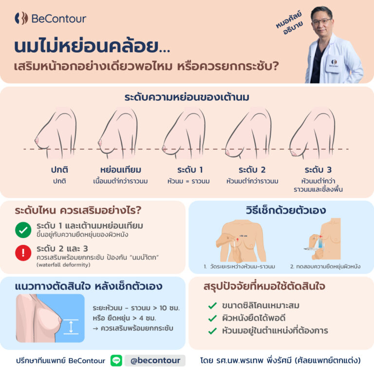 นมไม่หย่อนคล้อย เสริมหน้าอกอย่างเดียวพอไหม หรือควรยกกระชับ?