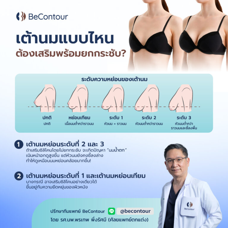 เต้านมแบบไหน ต้องเสริมพร้อมยกกระชับ?