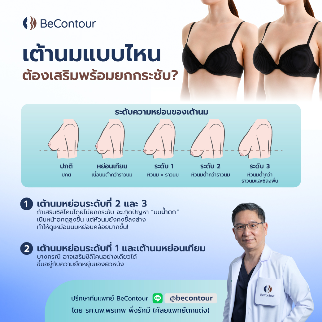 เต้านมแบบไหน ต้องเสริมพร้อมยกกระชับ?