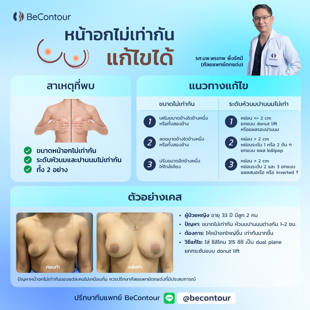 วิธีแก้ไขขนาดหน้าอกไม่เท่ากัน