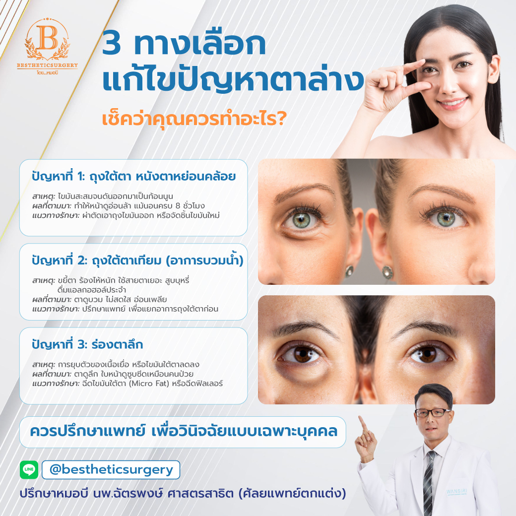 3 ทางเลือก แก้ปัญหาตาล่าง ให้หน้ากลับมาสดใสอีกครั้ง!