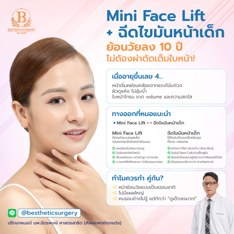 Mini Face Lift + ฉีดไขมันหน้าเด็ก ย้อนวัยลง 10 ปี... โดยไม่ต้องผ่าตัดเต็มใบหน้า!