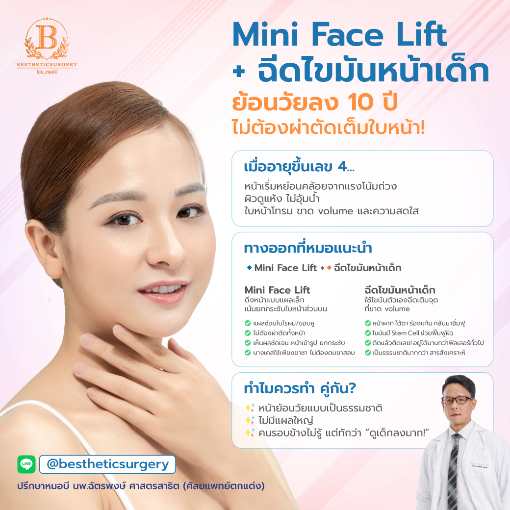 Mini Face Lift + ฉีดไขมันหน้าเด็ก ย้อนวัยลง 10 ปี... โดยไม่ต้องผ่าตัดเต็มใบหน้า!
