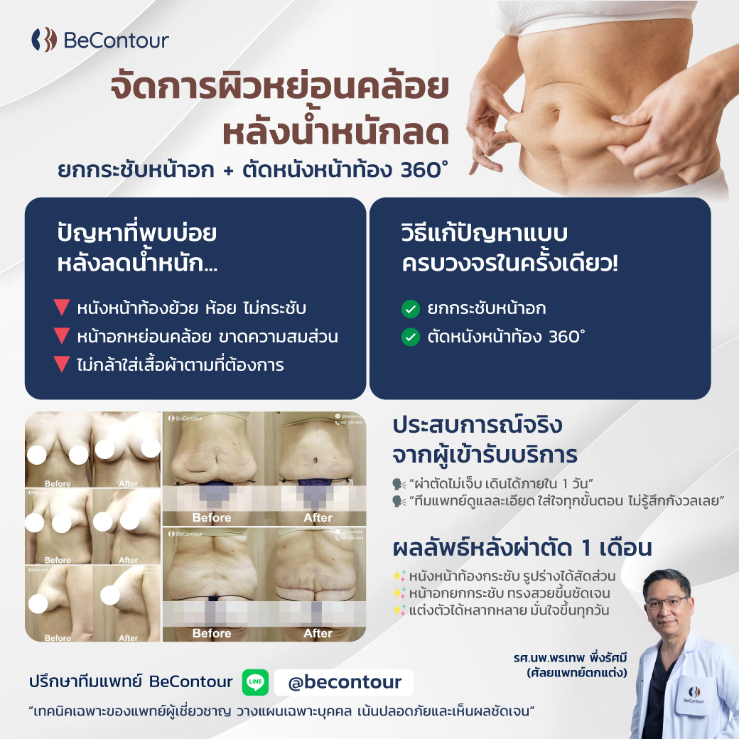ยกกระชับหน้าอก + ตัดหนังหน้าท้อง 360° วิธีจัดการผิวหย่อนคล้อย หลังน้ำหนักลด