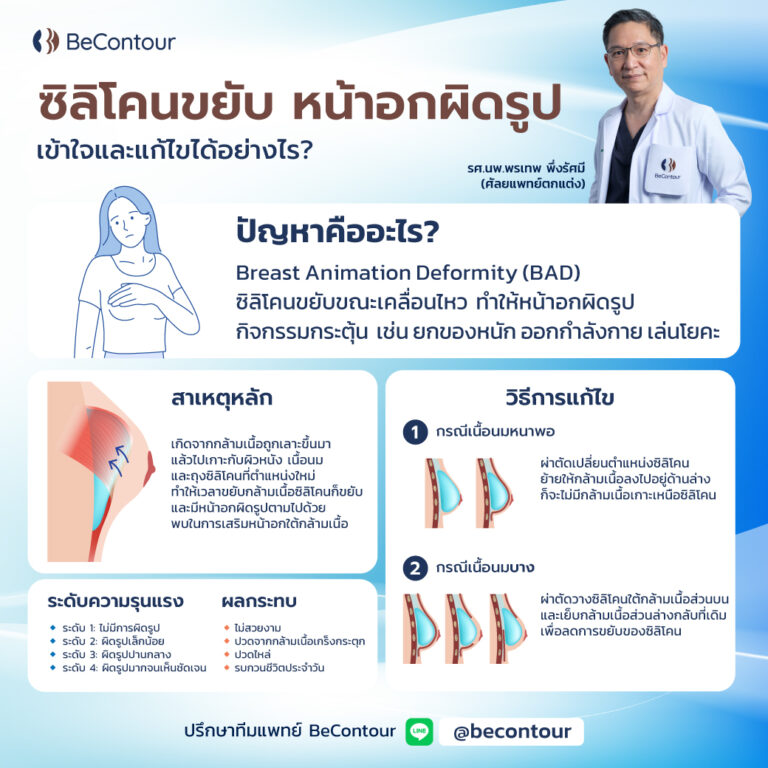 ซิลิโคนขยับ หน้าอกผิดรูป แก้ไขได้อย่างไร?