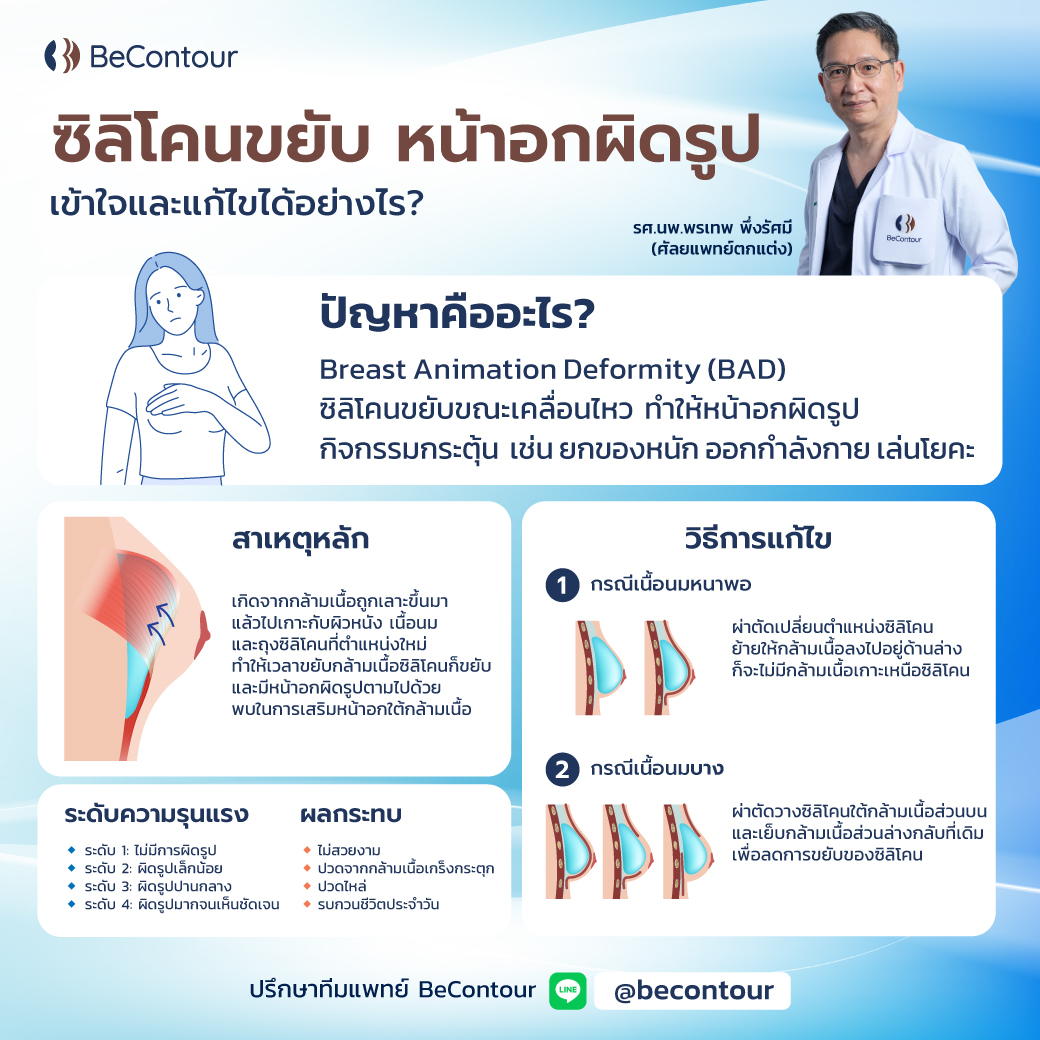 ซิลิโคนขยับ หน้าอกผิดรูป แก้ไขได้อย่างไร?