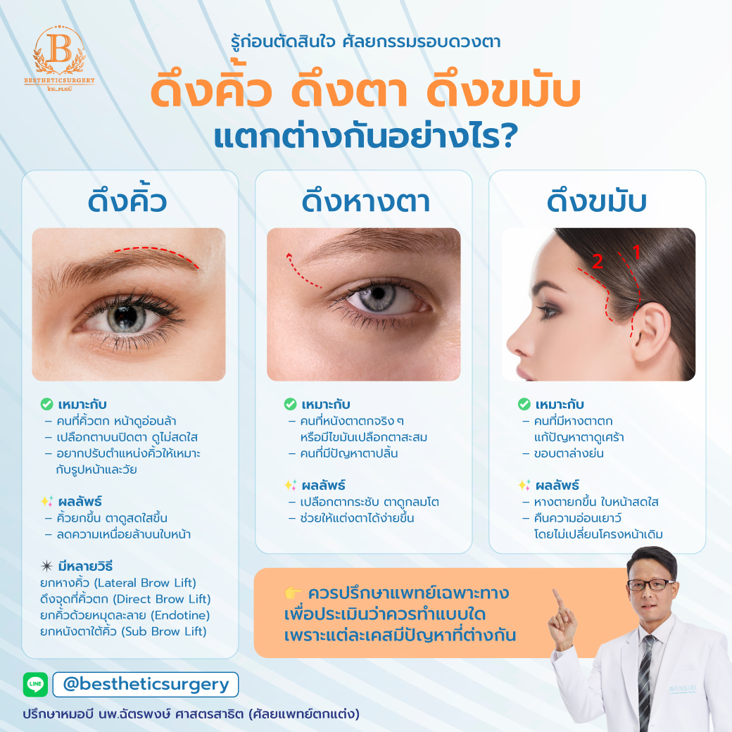 ศัลยกรรมรอบดวงตา ดึงคิ้ว ดึงตา ดึงขมับ ต่างกันยังไง?