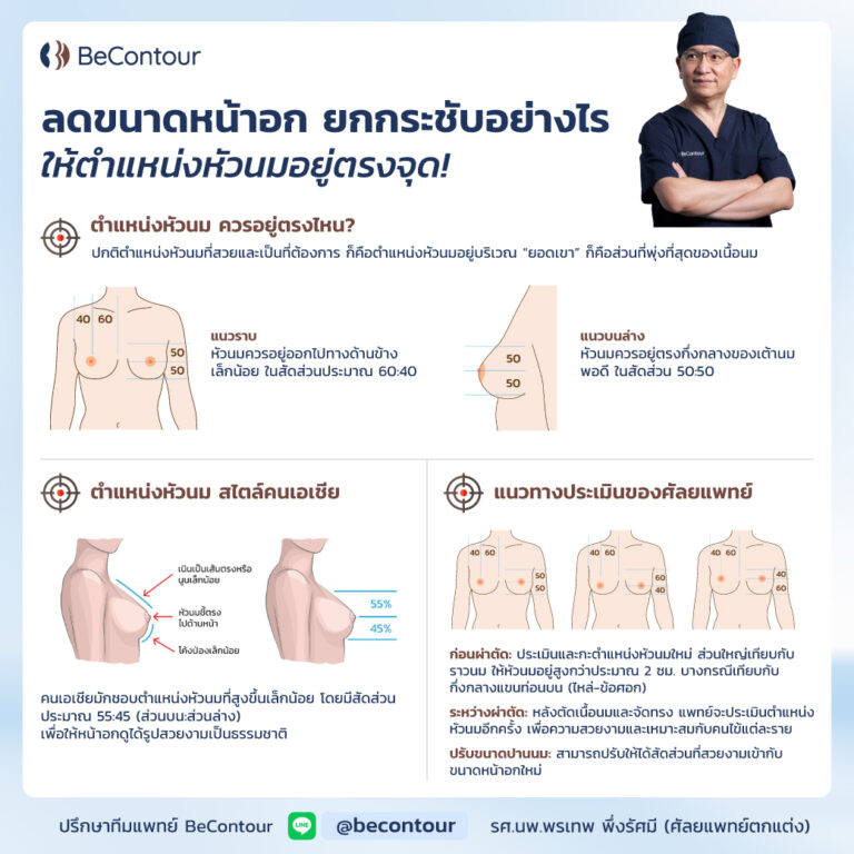 ลดขนาดหน้าอก ยกกระชับหน้าอก ตำแหน่งหัวนมควรอยู่ตรงไหน