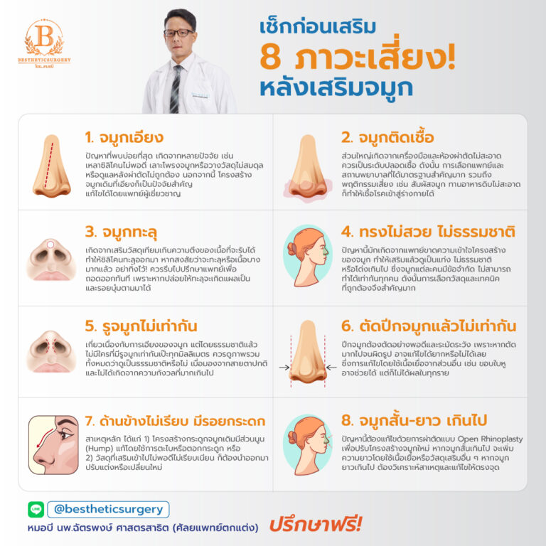8 ภาวะเสี่ยงหลังเสริมจมูกที่พบบ่อย