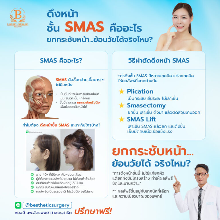 ดึงหน้าชั้น SMAS คืออะไร ยกกระชับหน้า ย้อนวัยได้จริงไหม?