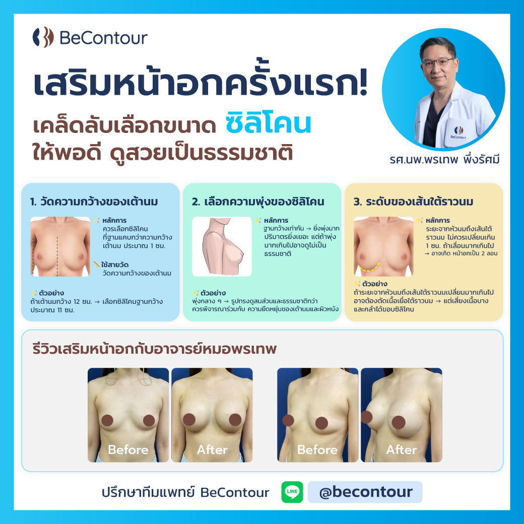 เสริมหน้าอกครั้งแรก เลือกขนาดซิลิโคนยังไง? ให้พอดี ดูสวยเป็นธรรมชาติ
