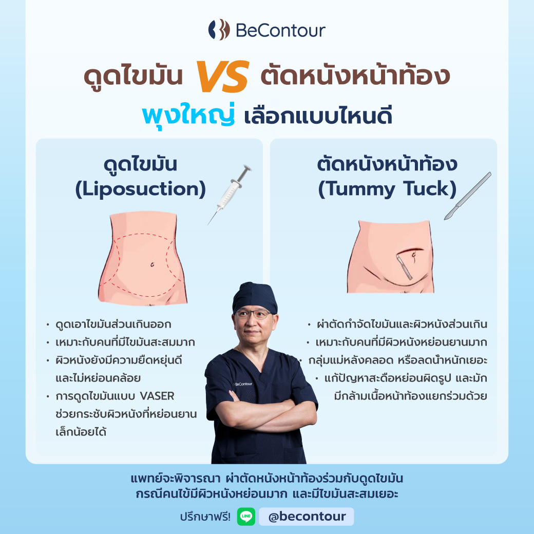 ดูดไขมัน vs ตัดหนังหน้าท้อง เลือกแบบไหนดี