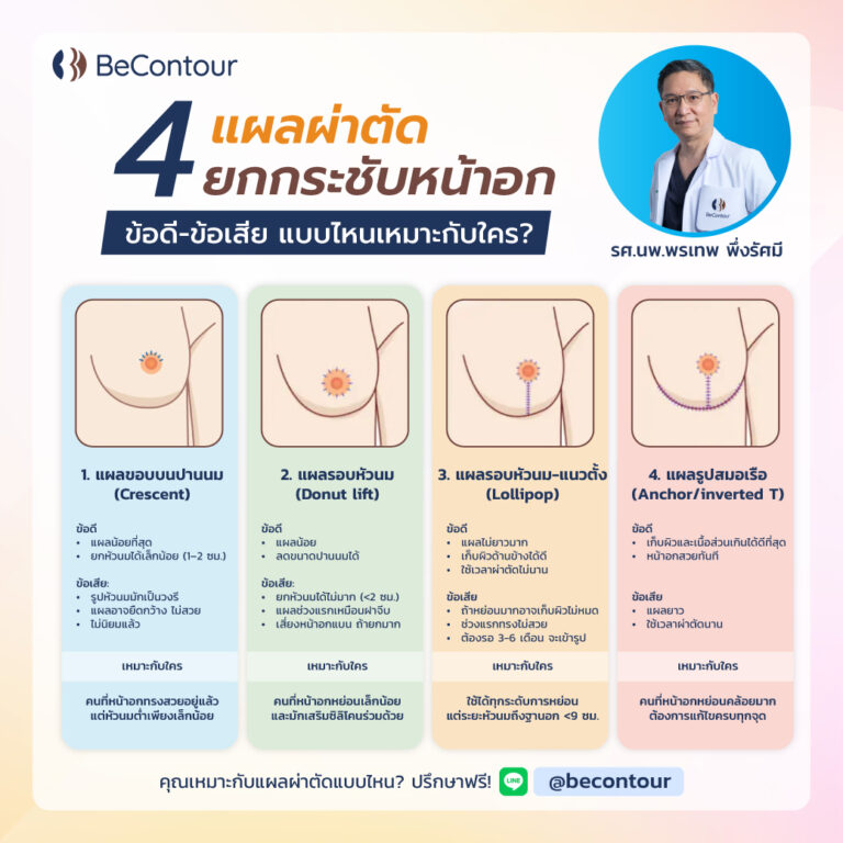 ยกกระชับหน้าอก เลือกแผลผ่าตัดแบบไหนดี?