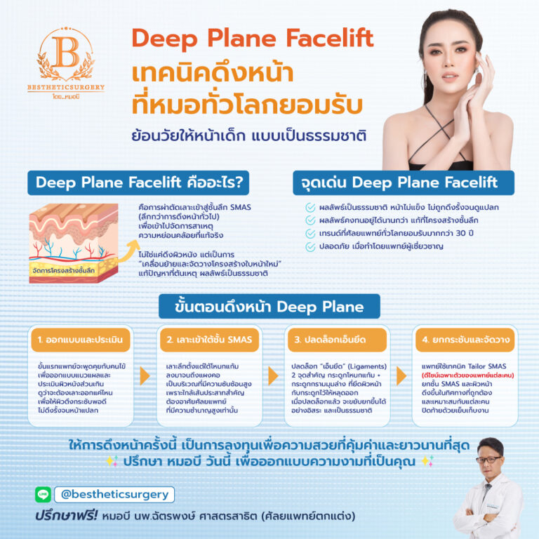 ดึงหน้า Deep Plane Facelift คืออะไร มีขั้นตอนอะไรบ้าง