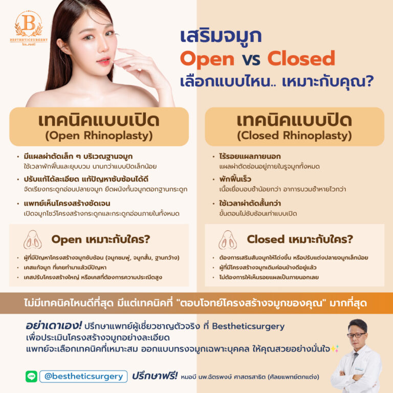 เสริมจมูก Open vs Closed ต่างกันอย่างไร แบบไหนเหมาะกับใคร