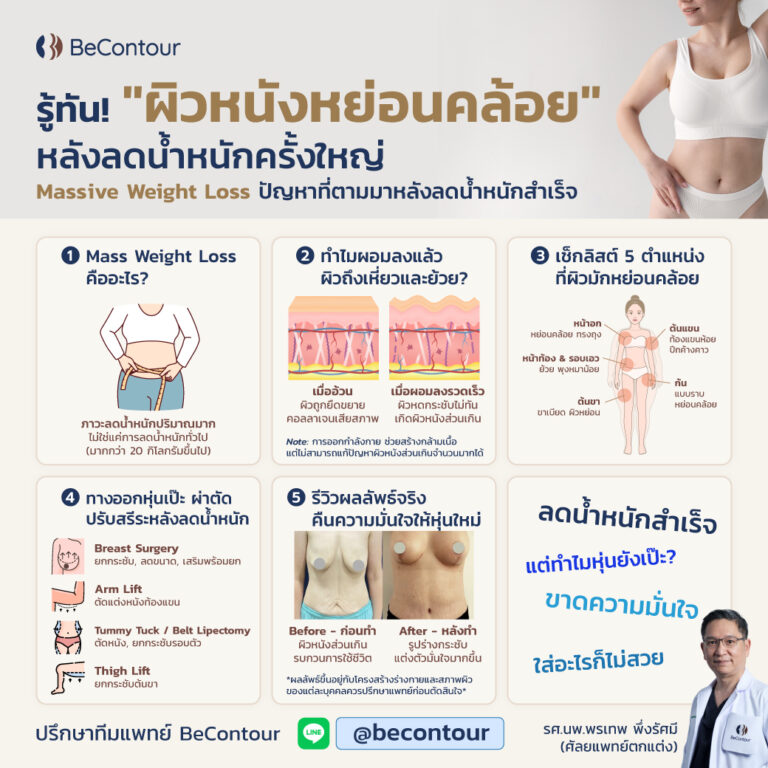 Massive Weight Loss ผิวย้วยหลังลดน้ำหนัก คืออะไร แก้ยังไง