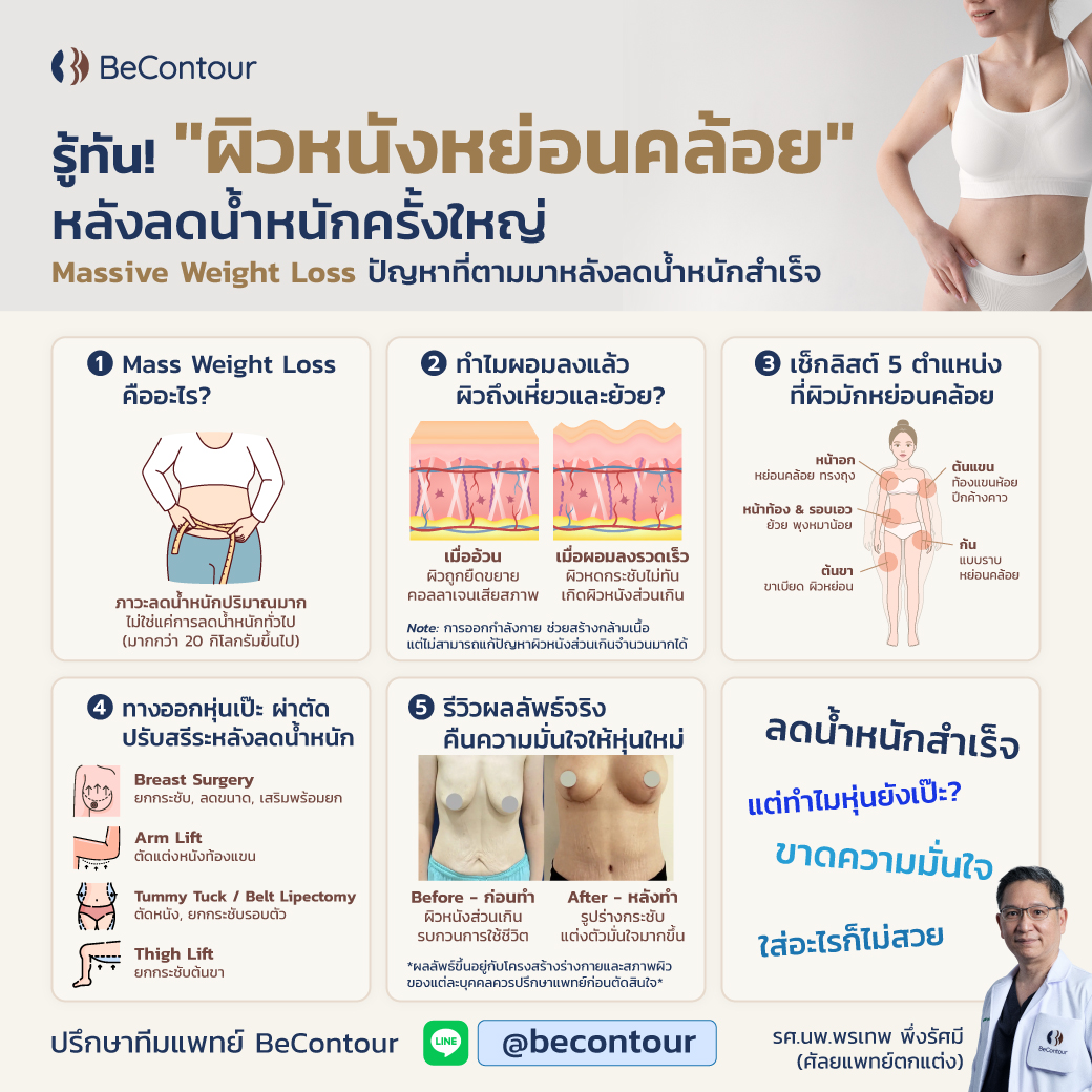 Massive Weight Loss ผิวย้วยหลังลดน้ำหนัก คืออะไร แก้ยังไง
