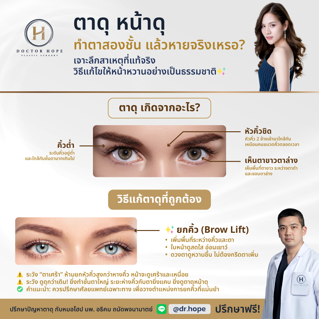 ตาดุ เกิดจากอะไร? วิธีแก้ตาดุ