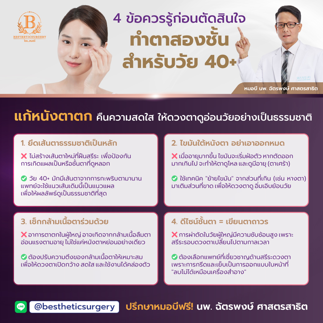 4 ข้อควรรู้ก่อนตัดสินใจ ทำตาสองชั้น สำหรับวัย 40+