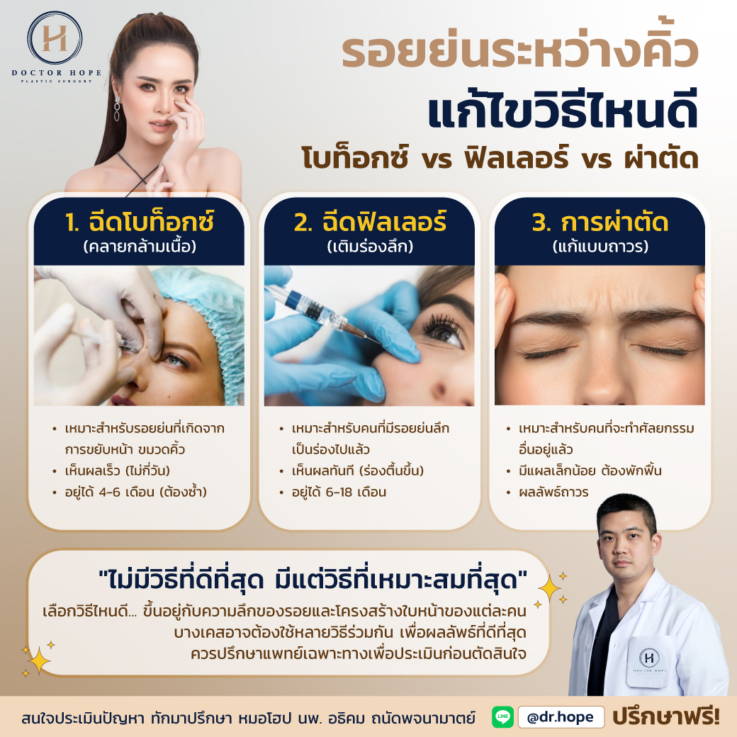 รอยย่นระหว่างคิ้ว แก้ไขวิธีไหนดี? เทียบชัด โบท็อกซ์ vs ฟิลเลอร์ vs ผ่าตัด