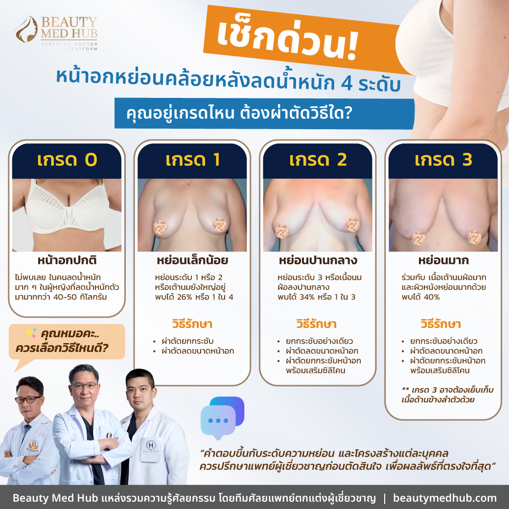 เช็คด่วน! หน้าอกหย่อนคล้อยหลังลดน้ำหนัก 4 ระดับ คุณอยู่เกรดไหน ต้องผ่าตัดวิธีใด?