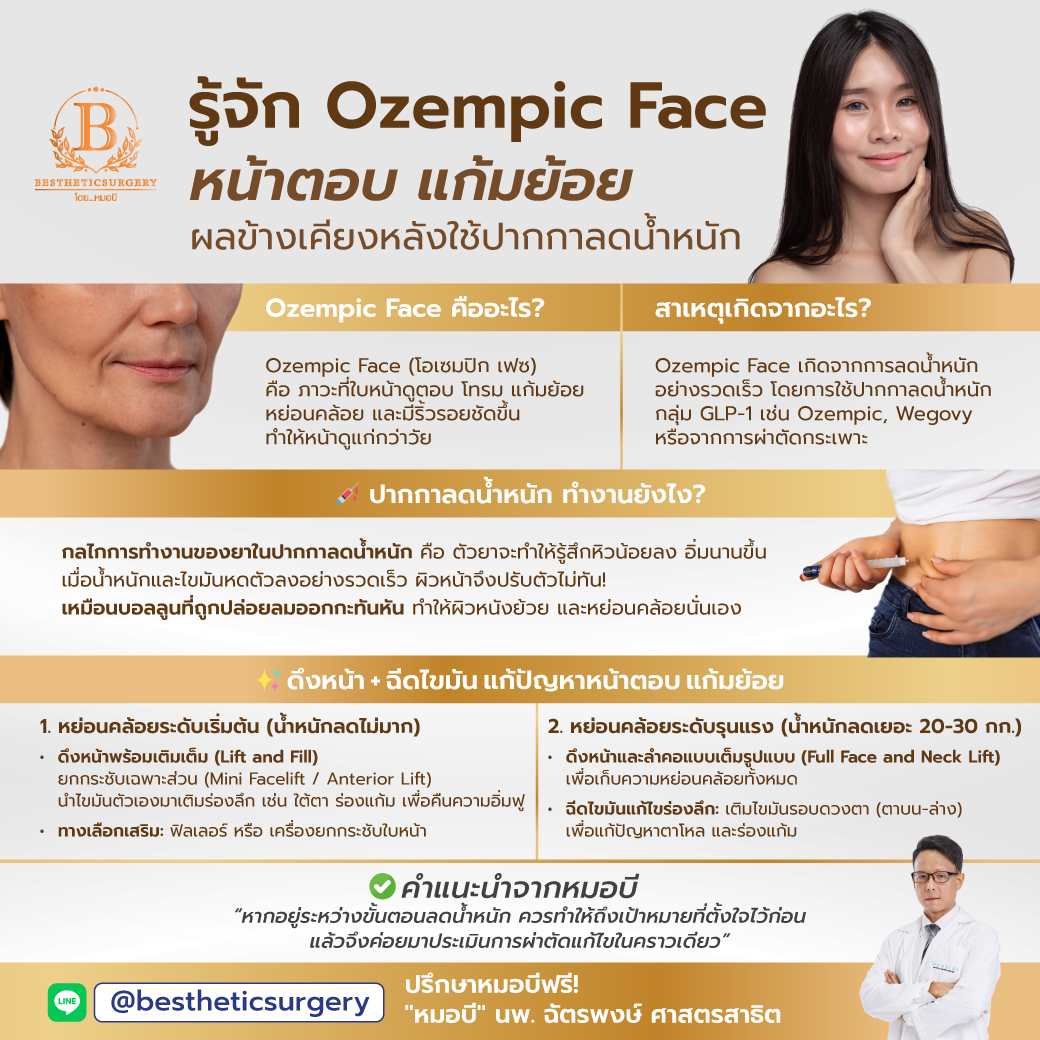 รู้จัก Ozempic Face ผลข้างเคียงหลังใช้ "ปากกาลดน้ำหนัก"