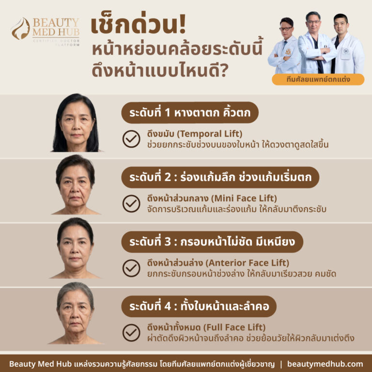 เช็ก! ระดับใบหน้าหย่อนคล้อย ต้องดึงหน้าแบบไหน?