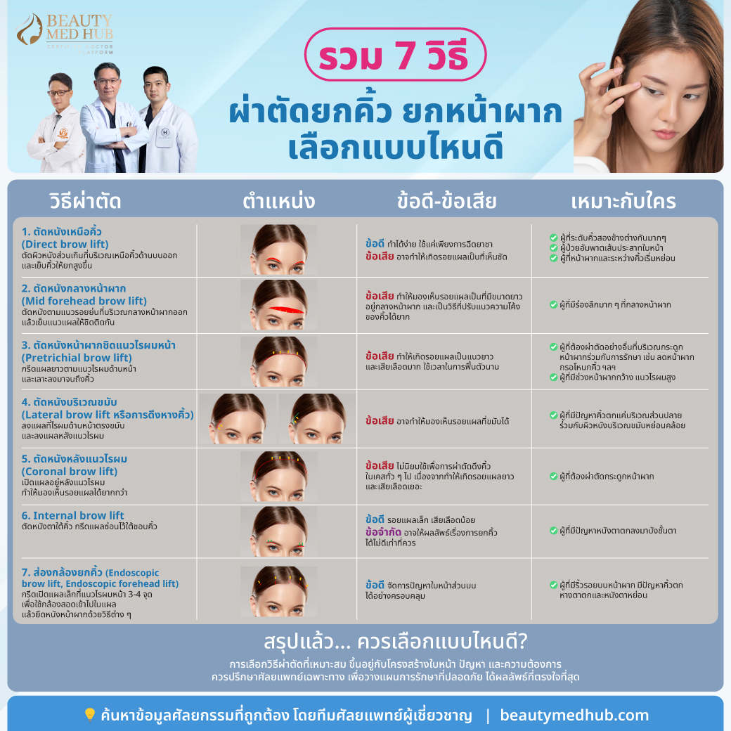 รวม 7 วิธีผ่าตัดยกคิ้ว & ยกหน้าผาก เลือกแบบไหนดี