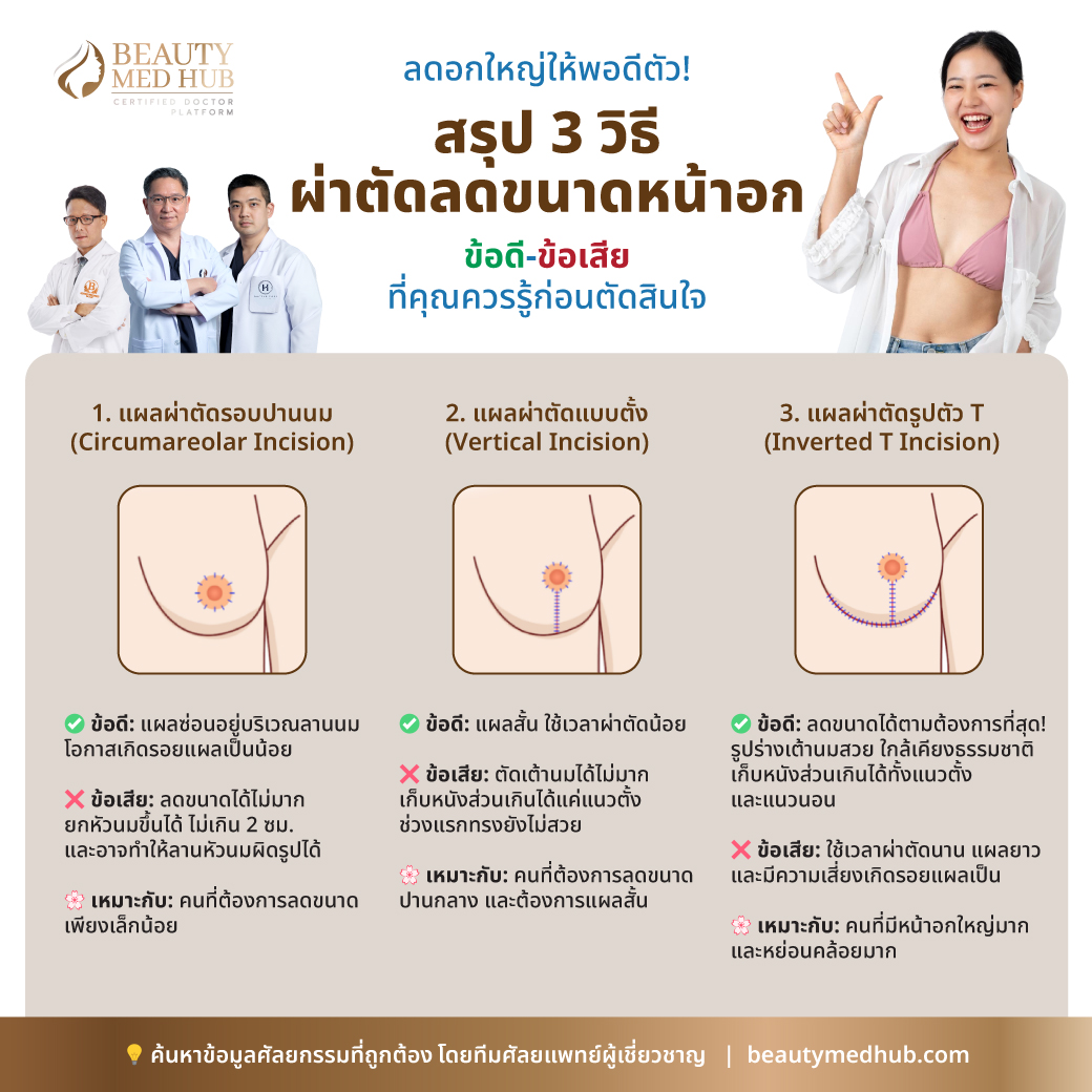 3 วิธีผ่าตัดลดขนาดหน้าอก ข้อดี-ข้อเสีย ที่คุณควรรู้ก่อนตัดสินใจ