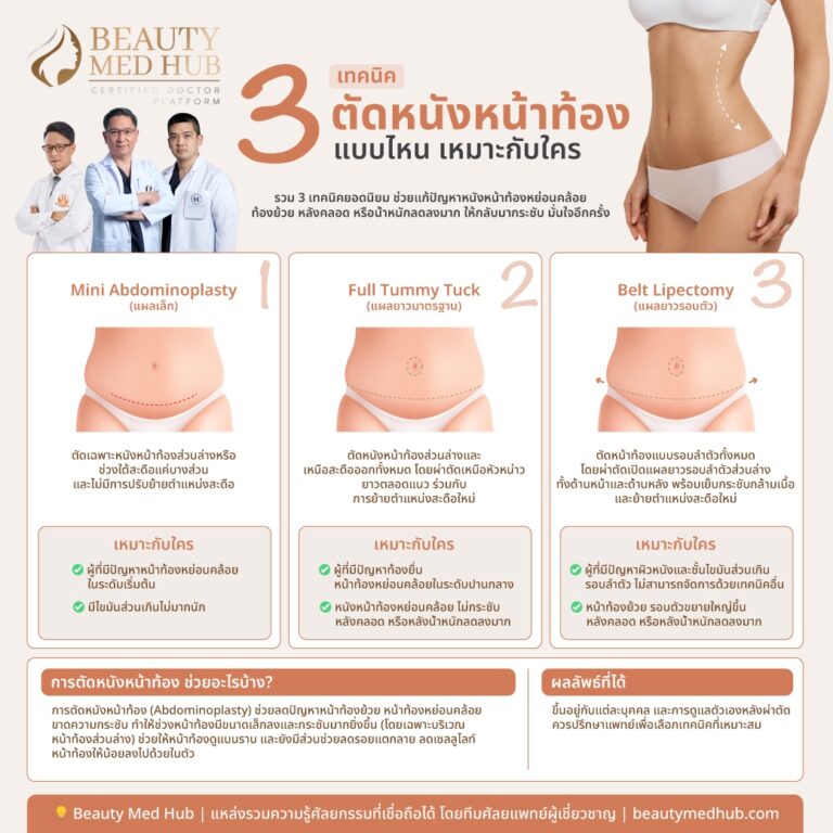 3 เทคนิค ตัดหนังหน้าท้อง แบบไหน เหมาะกับใคร