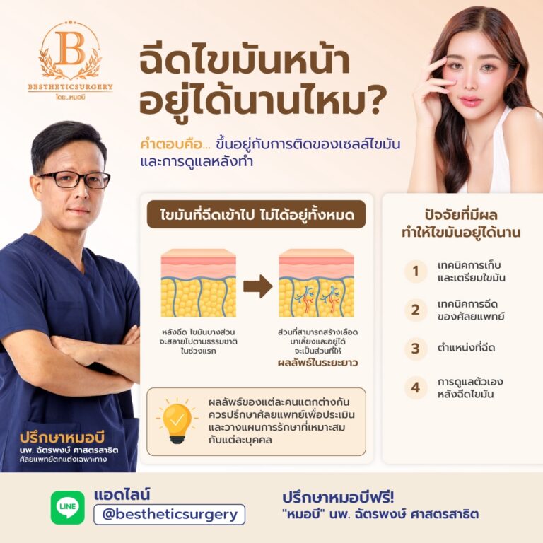 ฉีดไขมันหน้า อยู่ได้นานไหม?