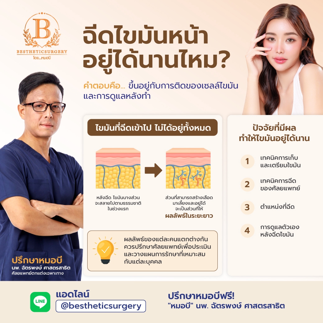 ฉีดไขมันหน้า อยู่ได้นานไหม?