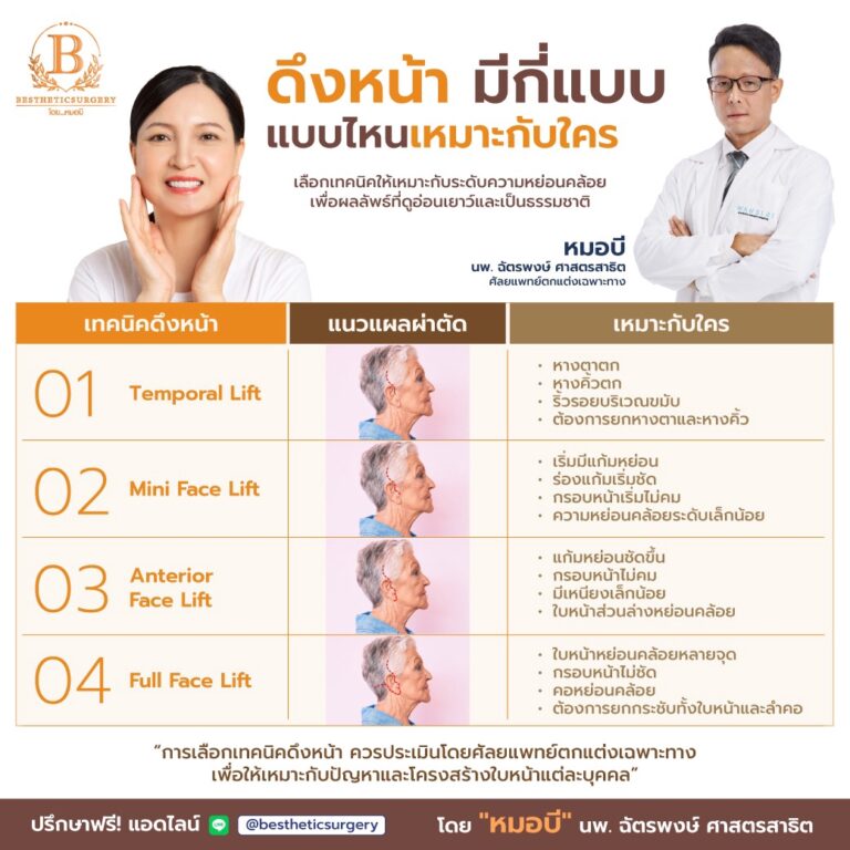 ดึงหน้า มีกี่แบบ แบบไหนเหมาะกับใคร?