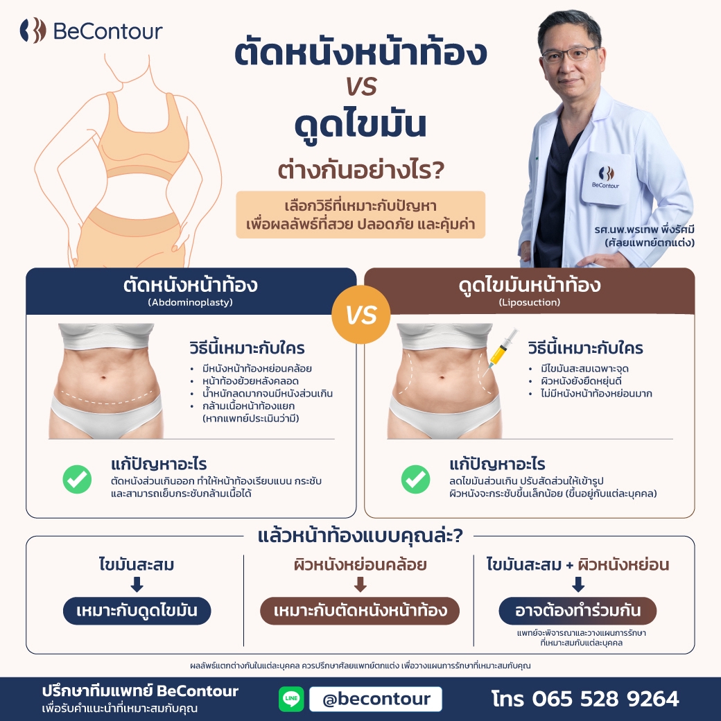 ตัดหนังหน้าท้อง VS ดูดไขมัน ต่างกันอย่างไร?