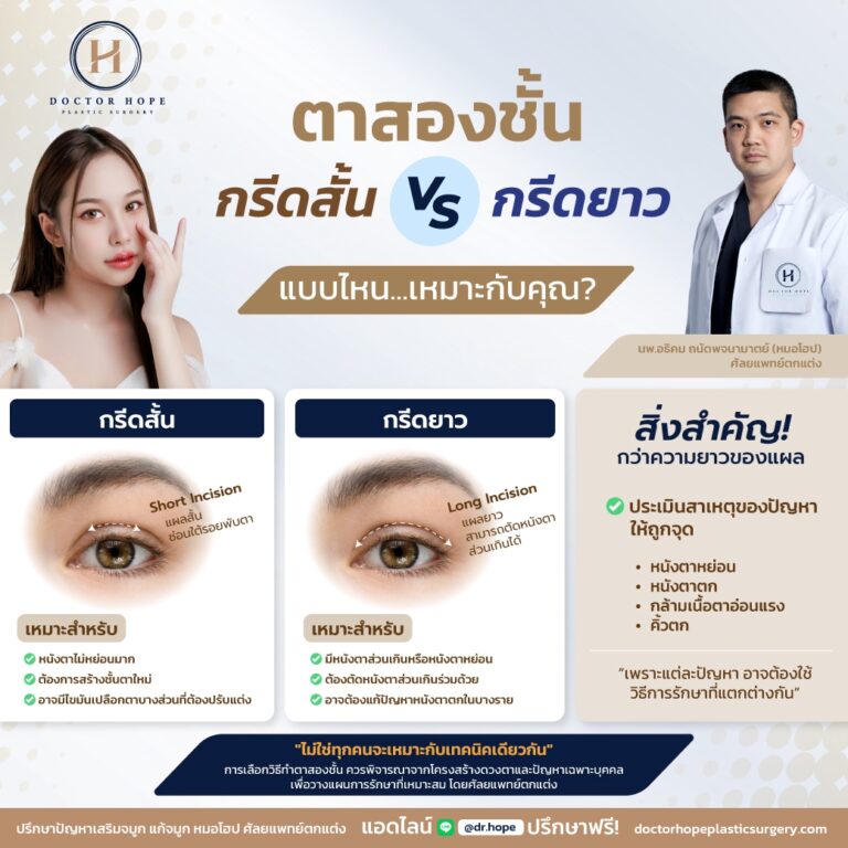ตาสองชั้น "กรีดสั้น VS กรีดยาว" แบบไหน...เหมาะกับคุณ?