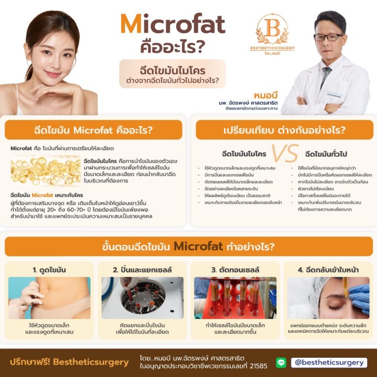 Microfat คืออะไร? ต่างจากฉีดไขมันทั่วไปอย่างไร