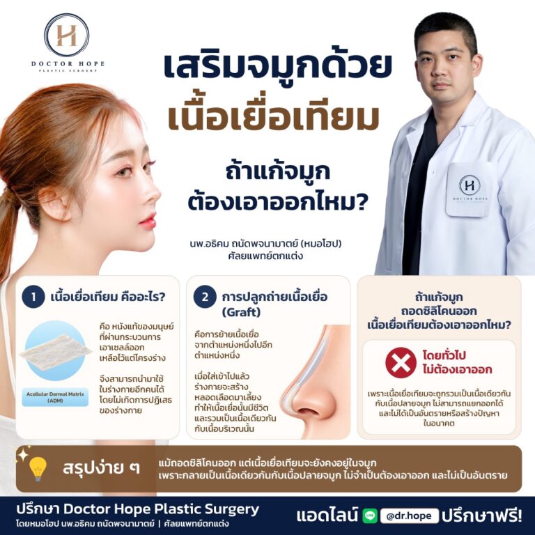 เสริมจมูกด้วยเนื้อเยื่อเทียม ถ้าจะแก้ต้องถอดออกหรือไม่?