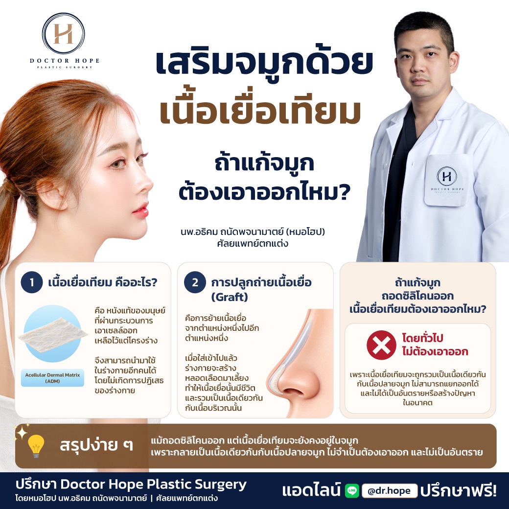 เสริมจมูกด้วยเนื้อเยื่อเทียม ถ้าจะแก้ต้องถอดออกหรือไม่?